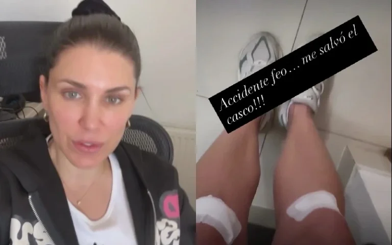 «Me salvó el casco»: Wilma González entrega detalles de su «feo accidente» y actualiza su estado de salud